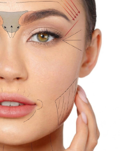 botox1