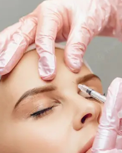 botox3