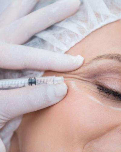 botox1